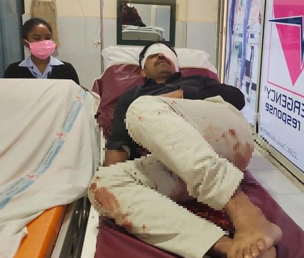 सड़क दुर्घटना में लोहरदगा के एसपी (ऑपरेशन) घायल, बेटे को भी लगी गंभीर चोट सड़क दुर्घटना में लोहरदगा के एसपी (ऑपरेशन) घायल, बेटे को भी लगी गंभीर चोट