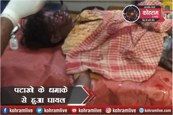 घर से खेलने निकला था लड़का, तभी हुआ धमाका, और... घर से खेलने निकला था लड़का, तभी हुआ धमाका, और...