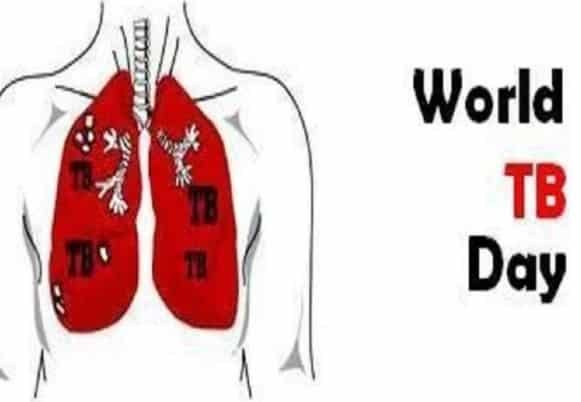 World Tuberculosis Day 2021: जानिए टीबी के लक्षण, ऐसे करें बचाव... World Tuberculosis Day 2021: जानिए टीबी के लक्षण, ऐसे करें बचाव...