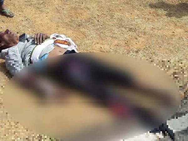 ऑटो ने बाइक सवार को मारी टक्कर, युवक का पैर टूटकर हुआ अलग ऑटो ने बाइक सवार को मारी टक्कर, युवक का पैर टूटकर हुआ अलग