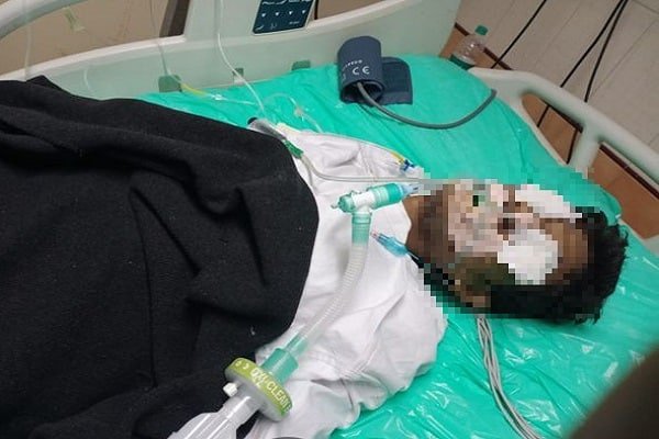 ICU में भर्ती मरीज की आंख कुतर गया चूहा... ICU में भर्ती मरीज की आंख कुतर गया चूहा...