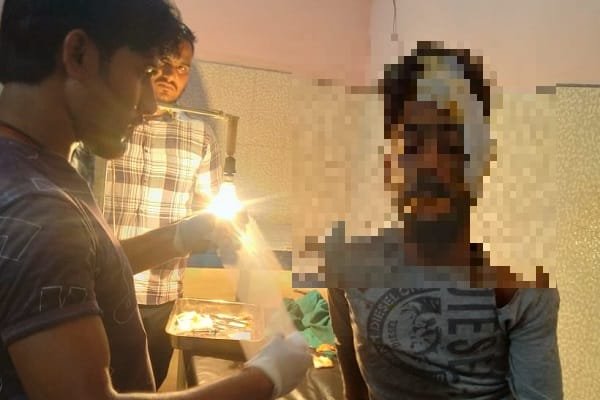 दो Bike में जोरदार टक्कर, एक जख्मी दो Bike में जोरदार टक्कर, एक जख्मी