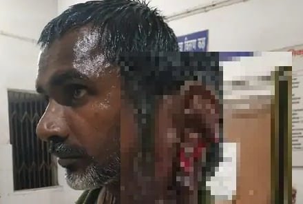 भाभी को नहीं दिया वोट, तो भड़के देवर ने देखिये क्या कर डाला भाभी को नहीं दिया वोट, तो भड़के देवर ने देखिये क्या कर डाला