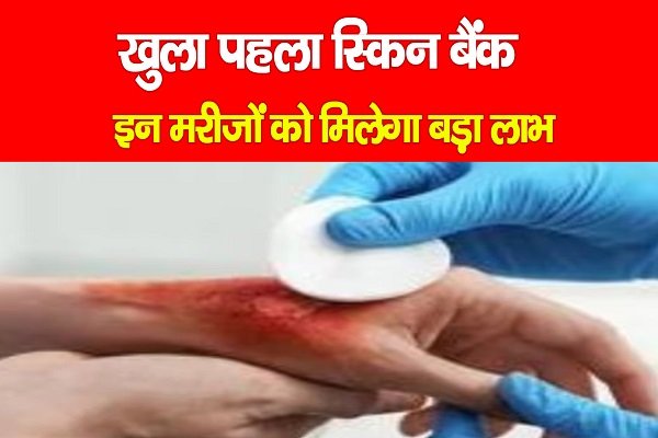 खुला पहला स्किन बैंक, इन मरीजों को मिलेगा बड़ा लाभ खुला पहला स्किन बैंक, इन मरीजों को मिलेगा बड़ा लाभ