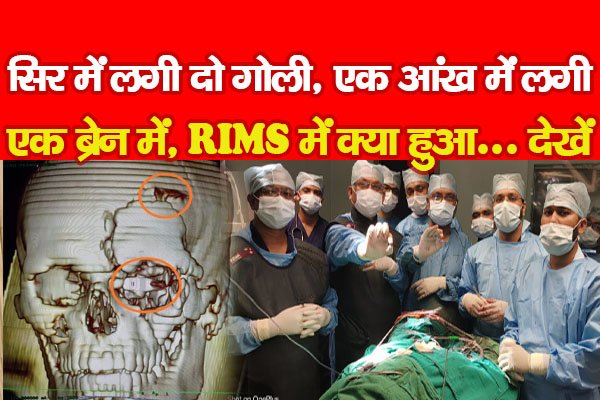 सिर में लगी दो गोली, एक आंख में लगी, एक ब्रेन में, RIMS में क्या हुआ... देखें सिर में लगी दो गोली, एक आंख में लगी, एक ब्रेन में, RIMS में क्या हुआ... देखें