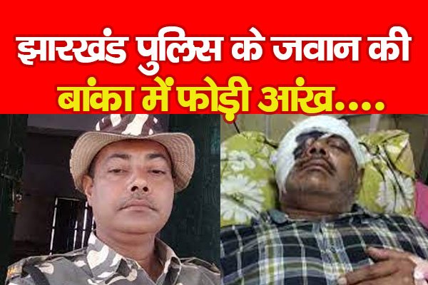 झारखंड पुलिस के जवान की बांका में फोड़ी आंख... झारखंड पुलिस के जवान की बांका में फोड़ी आंख...