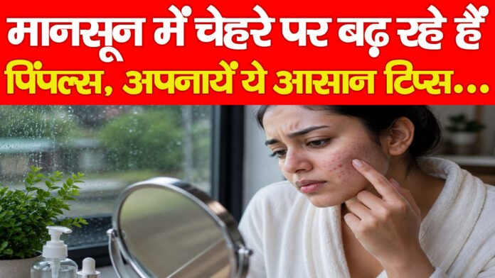 मानसून में चेहरे पर बढ़ रहे हैं पिंपल्स, अपनायें ये आसान टिप्स…