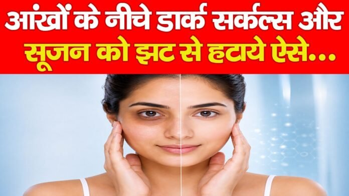 डार्क सर्कल्स